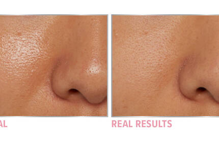 Product before image