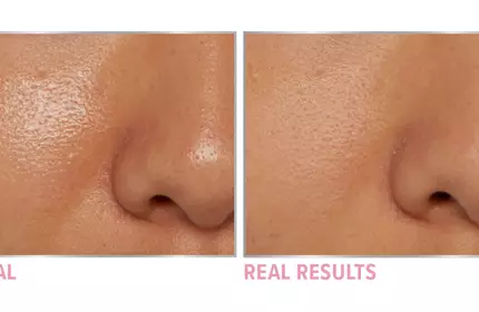 Product before image