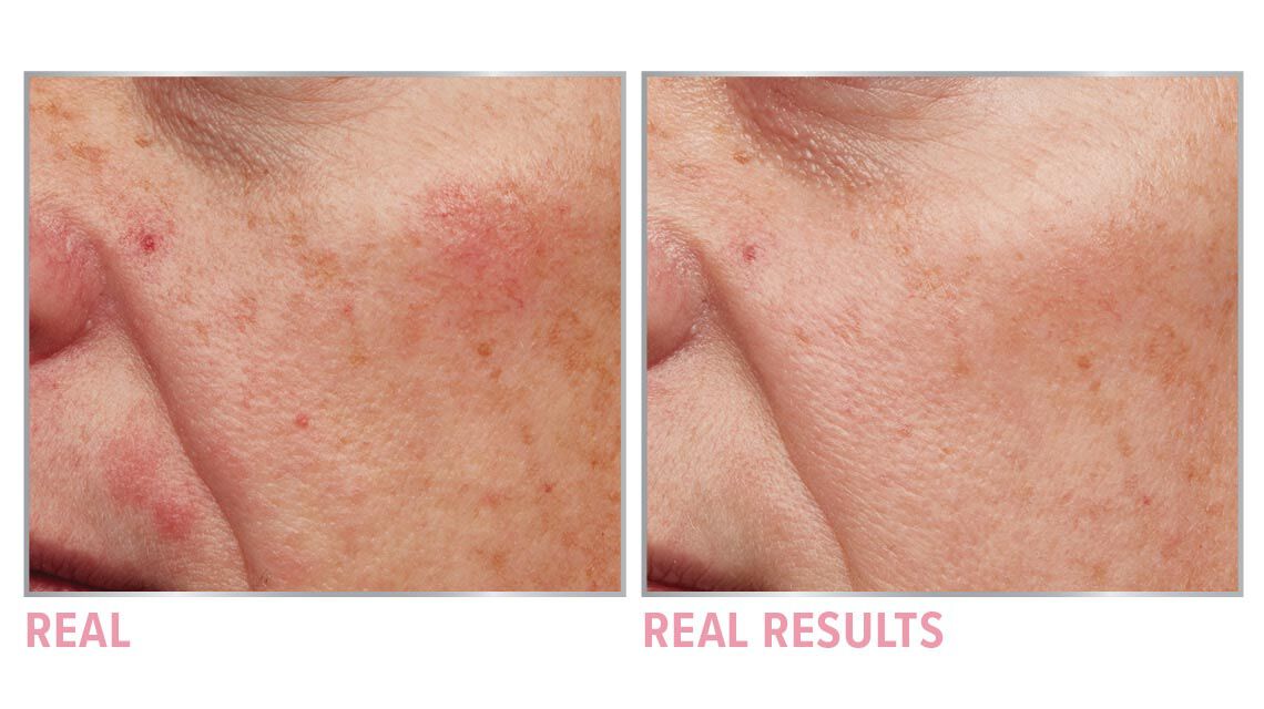 Product before image