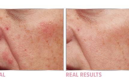 Product before image