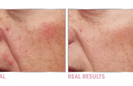 Product before image
