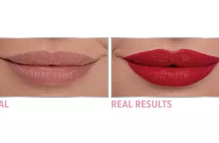 Product before image