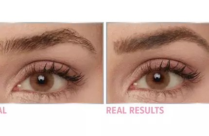 Product before image