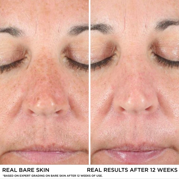 Skinceuticals