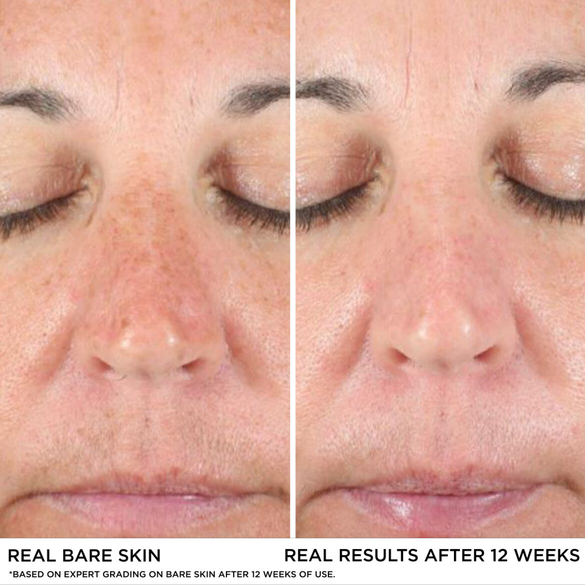 Skinceuticals