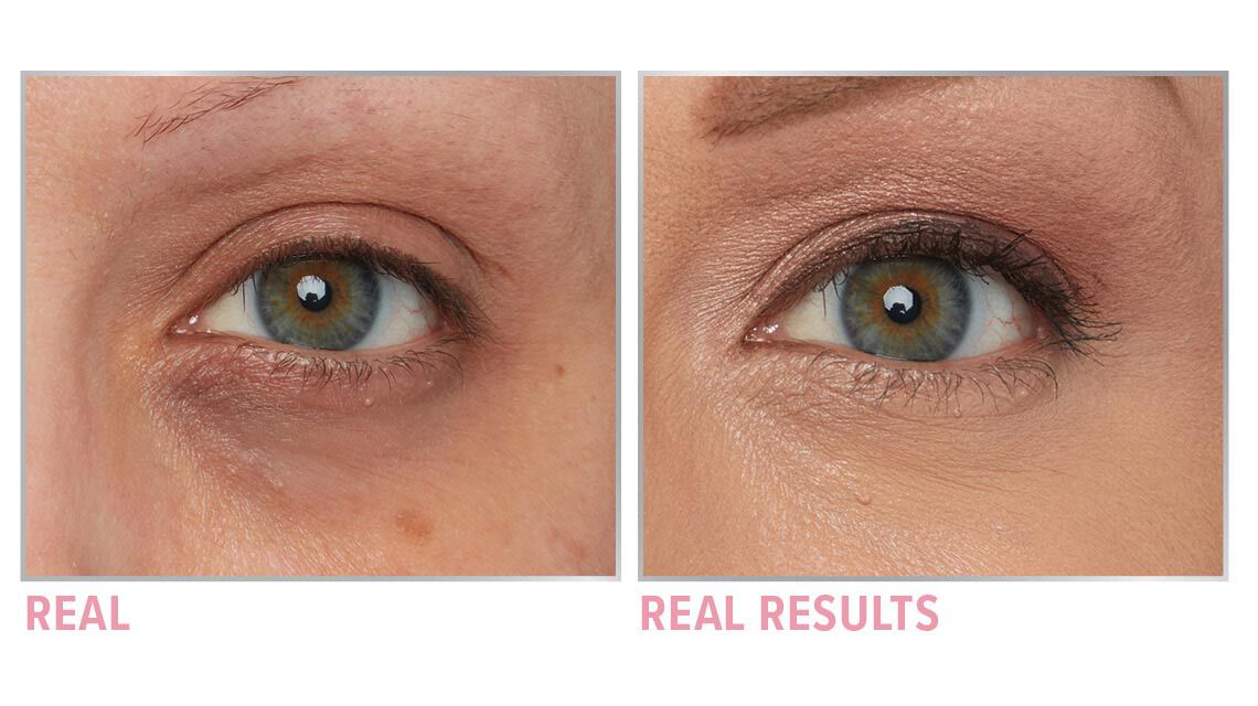 Product before image