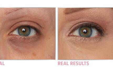 Product before image