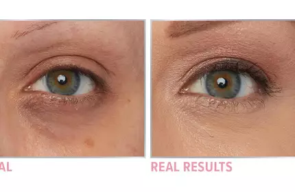 Product before image