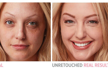 Product before image