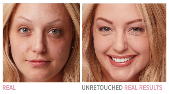 Skinceuticals