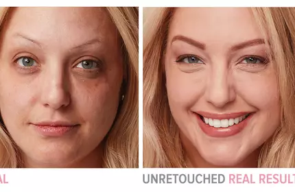Product before image