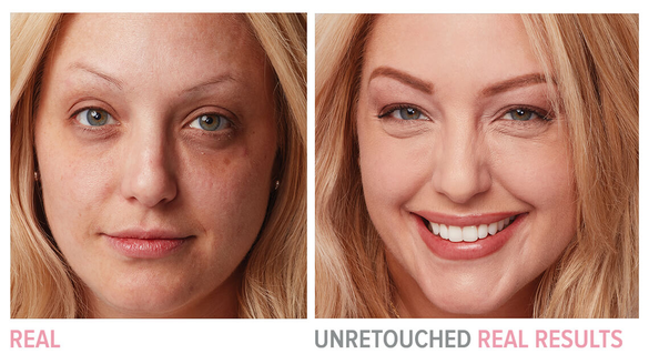 Skinceuticals