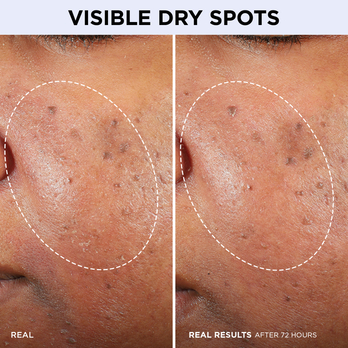 VISIBLE DRY SPOTS