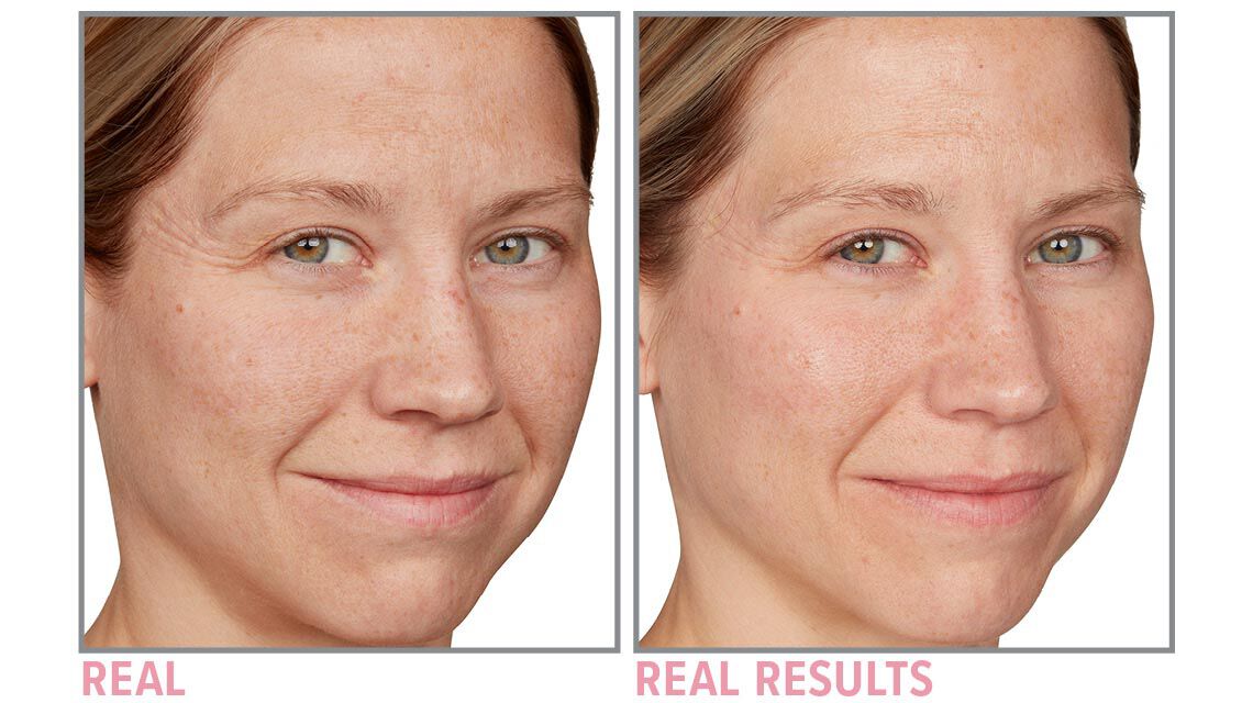 Product before image