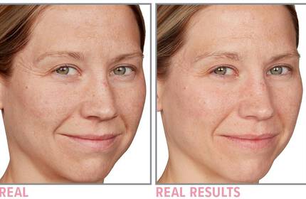 Product before image