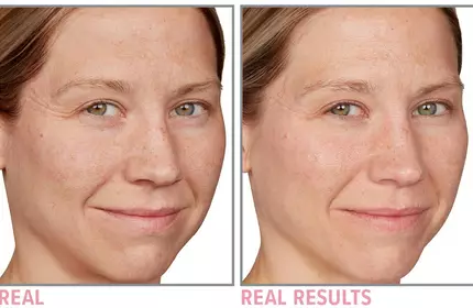 Product before image