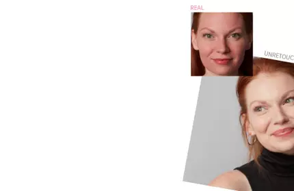 Before-and-after photos of a woman with red hair showing real, unretouched skin improvement.