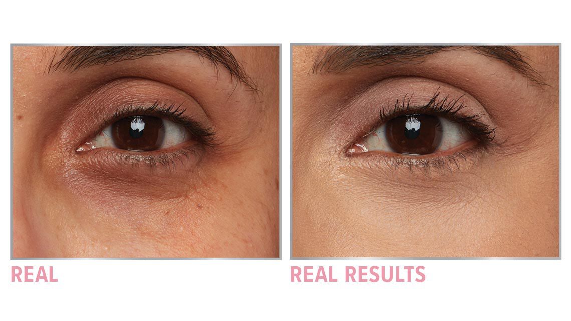 Product before image