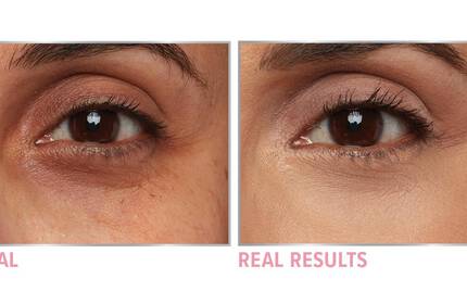 Product before image