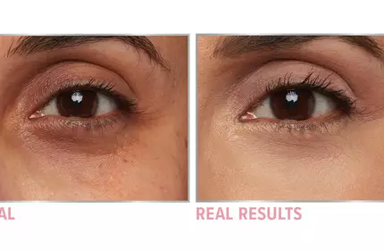 Product before image