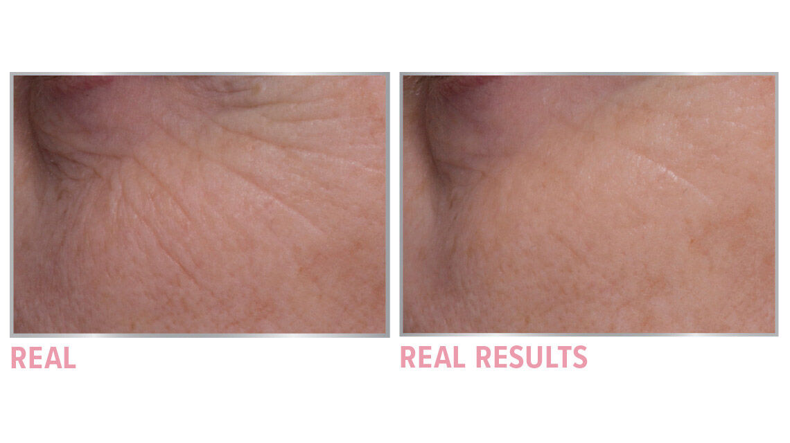 Product before image
