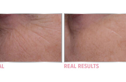 Product before image