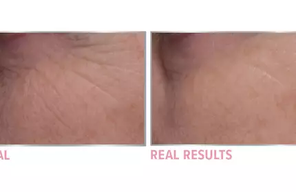 Product before image