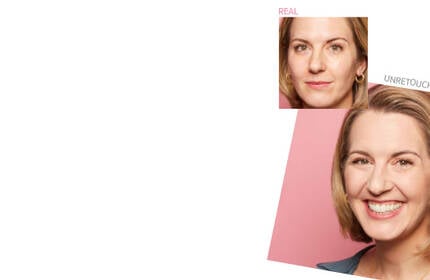 Before-and-after photos of smiling woman with blonde hair showing real, unretouched skincare results.