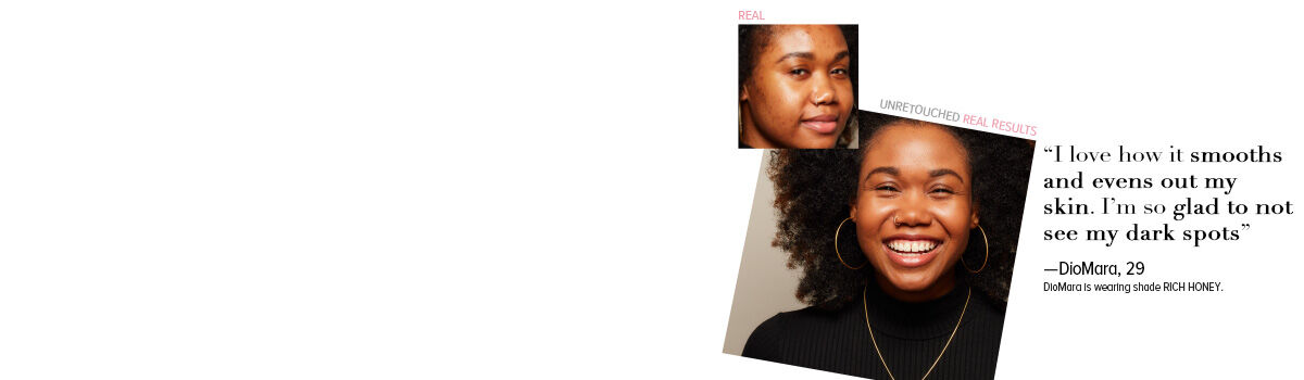 Before-and-after photos of a woman with curly hair showing real, unretouched skin improvement and a bright smile.