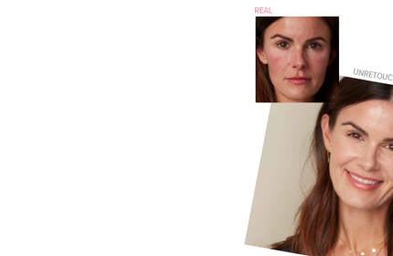 Before and after results of IT Cosmetics skincare on a woman with redness, showing smoother, even-toned skin after use.