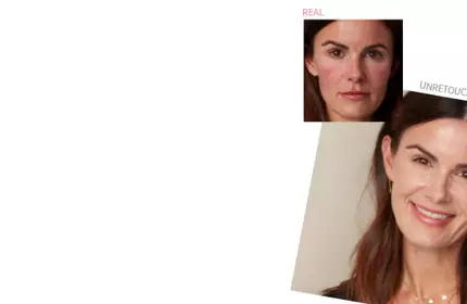 Before and after results of IT Cosmetics skincare on a woman with redness, showing smoother, even-toned skin after use.