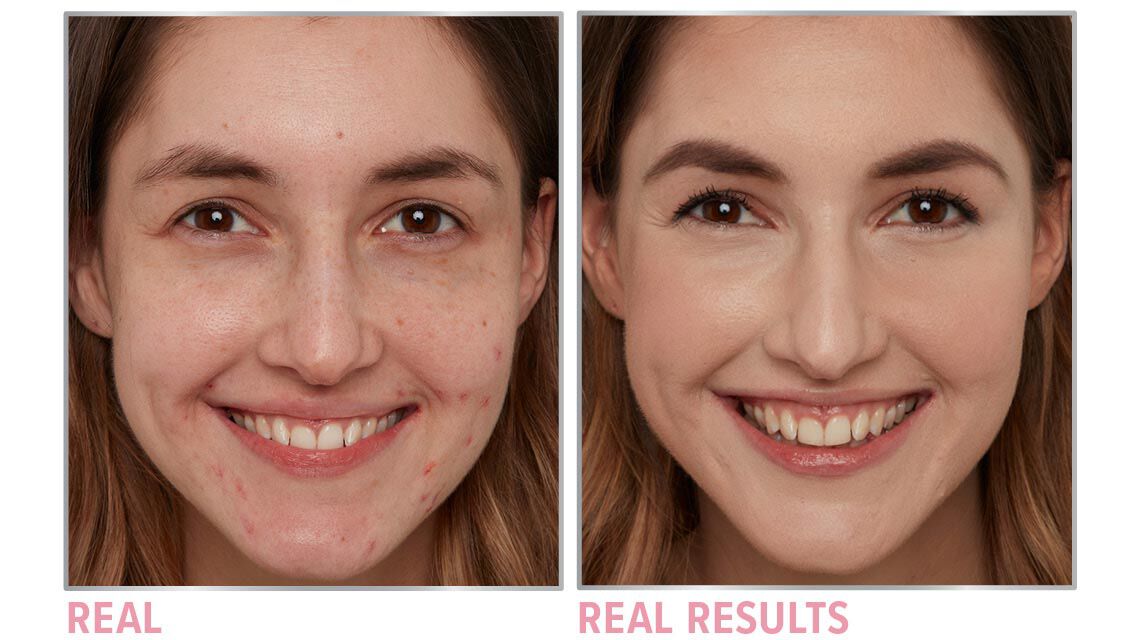 Product before image