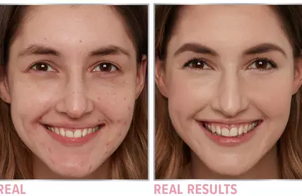 Product before image