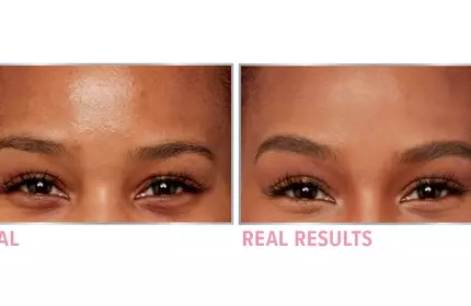 Product before image