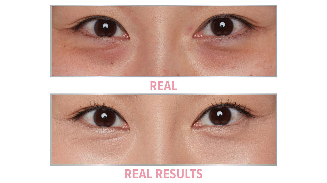 Product before image