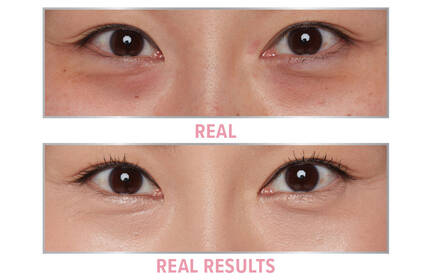 Product before image