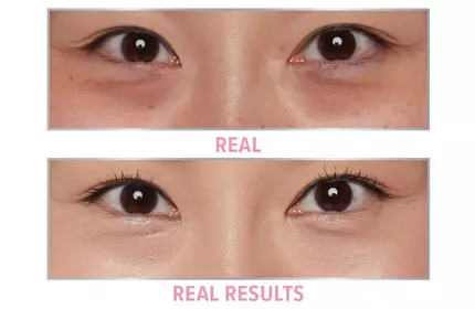 Product before image