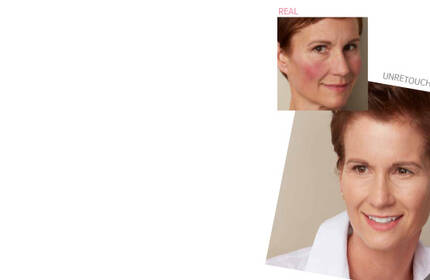 Before and after results of IT Cosmetics skincare on a woman with visible redness, showing improved complexion and radiance.