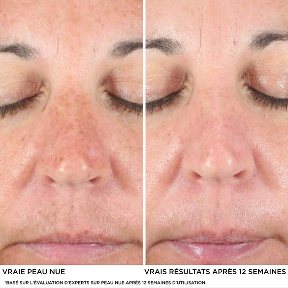 Skinceuticals