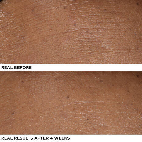 Serum anti-age et eclat Confidence in Your Beauty Sleep™