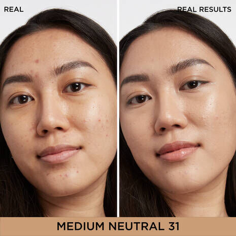 Bye Bye Dark Spots Concealer + Serum with 2% Niacinamide