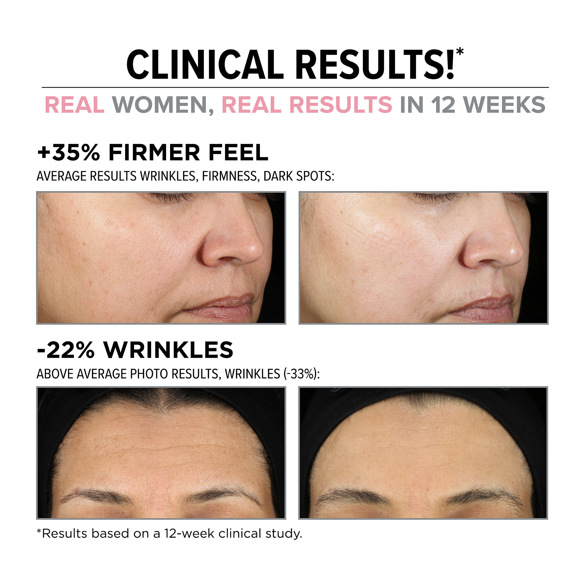 Hello Results Wrinkle-Reducing Daily Retinol - Creme-serum