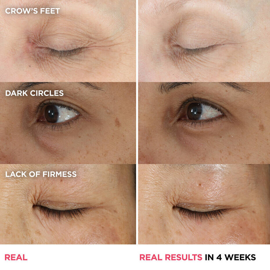 Peptide sales eye cream
