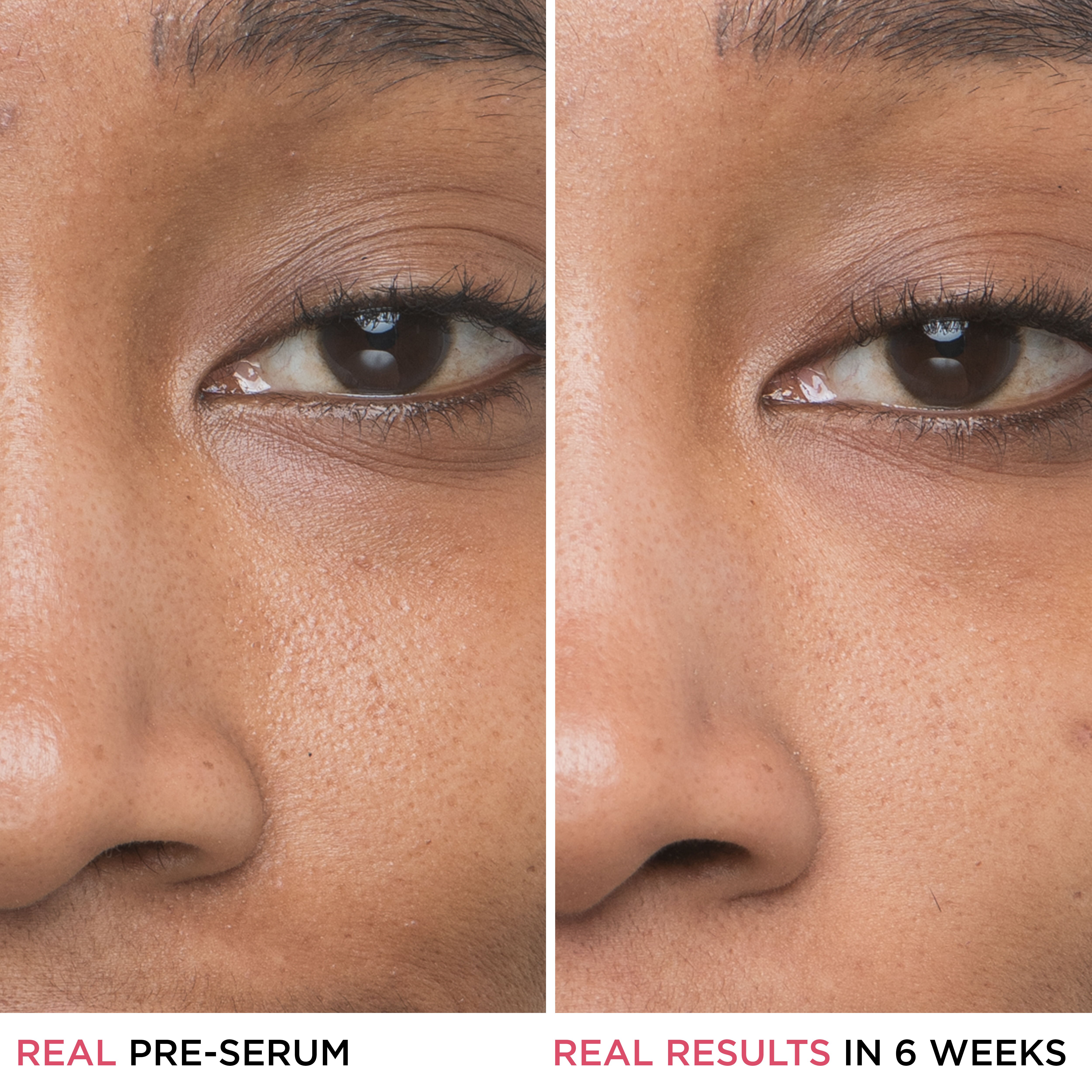 Bye Bye Pores 10% Glycolic Acid Serum