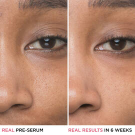 Bye Bye Pores 10% Glycolic Acid Serum