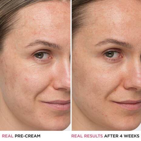 Confidence in a Cream Supercharged | Creme hydratante anti-age