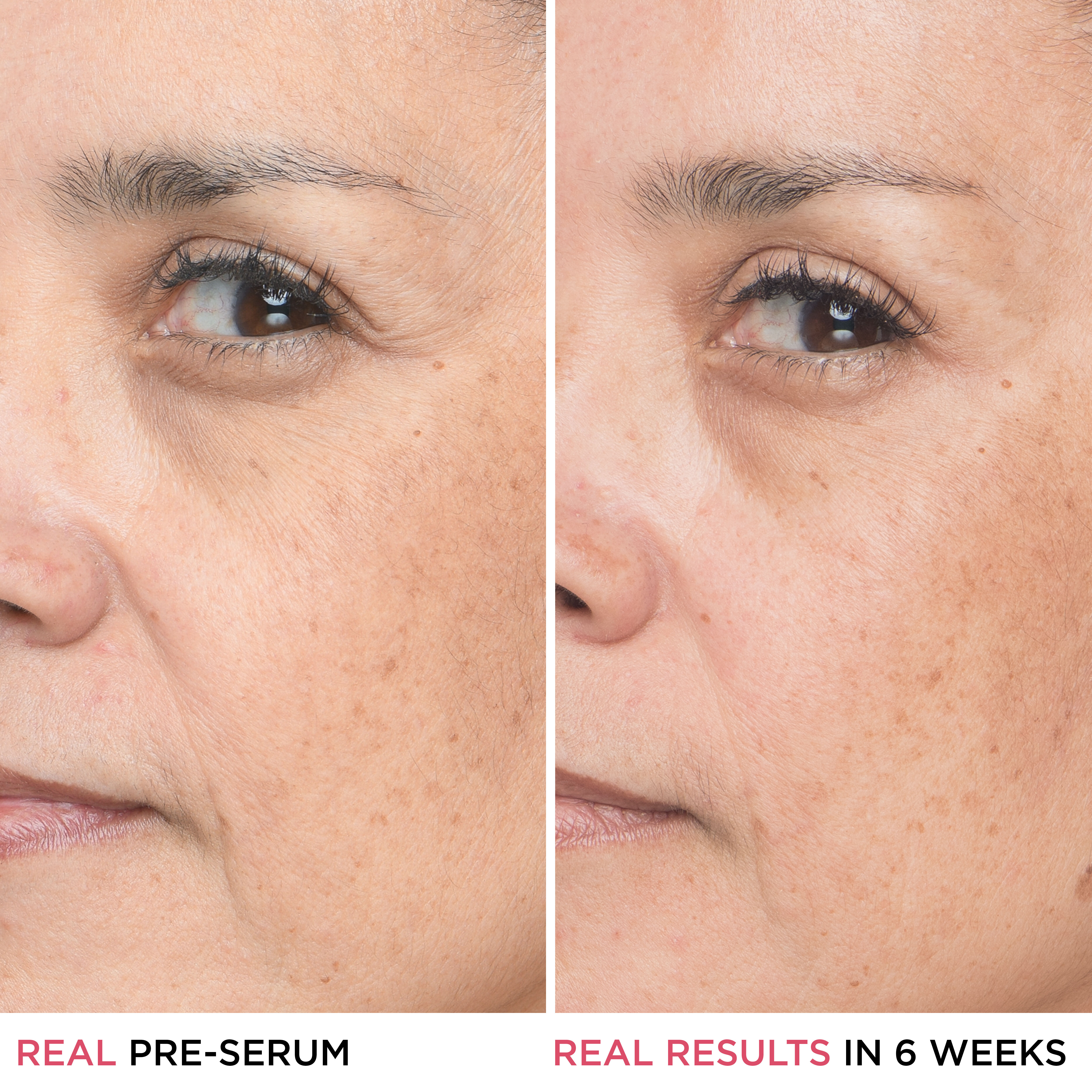 Bye Bye Lines 1.5% Hyaluronic Acid Serum