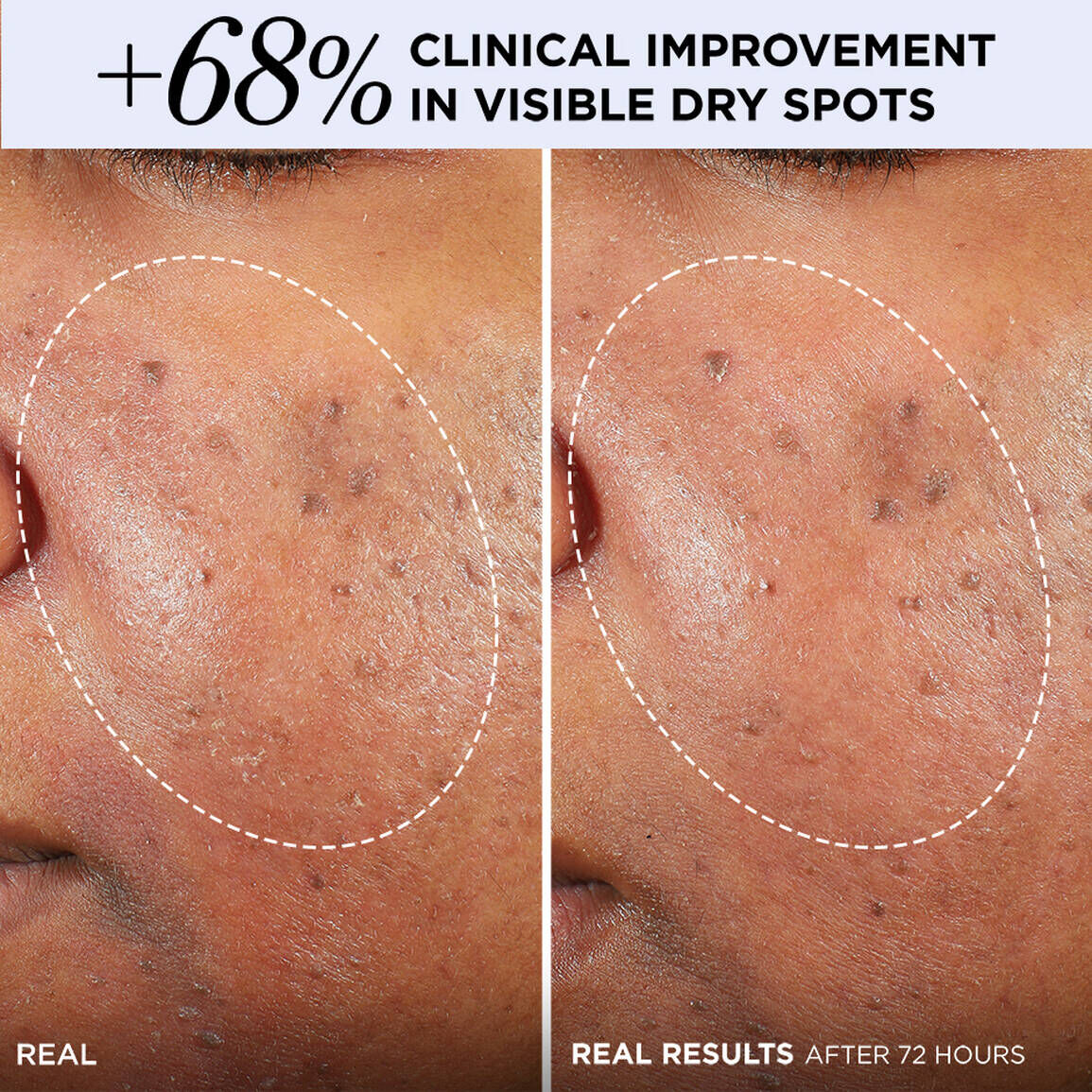 Confidence in a Cream® Barrier Boost Skin Barrier Repair Moisturizer