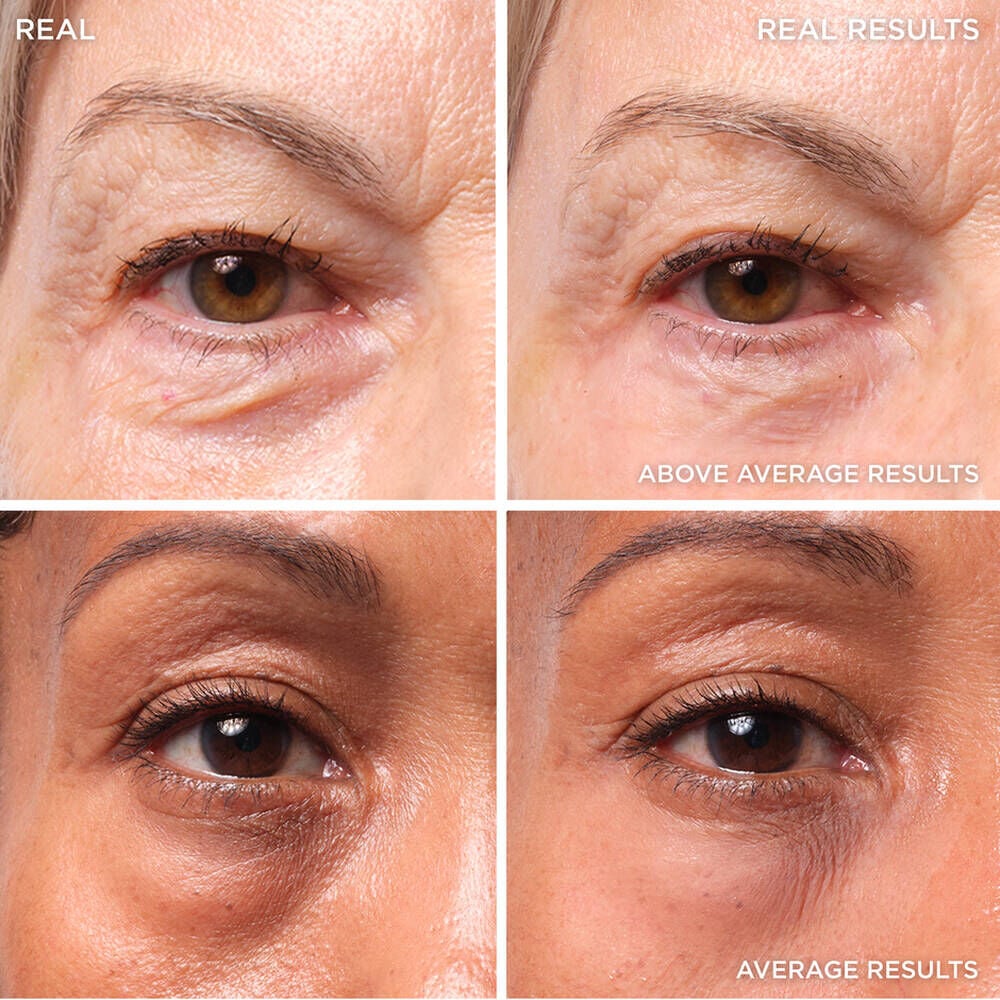 Bye Bye Under Eye Bags Treatment Skincare IT Cosmetics