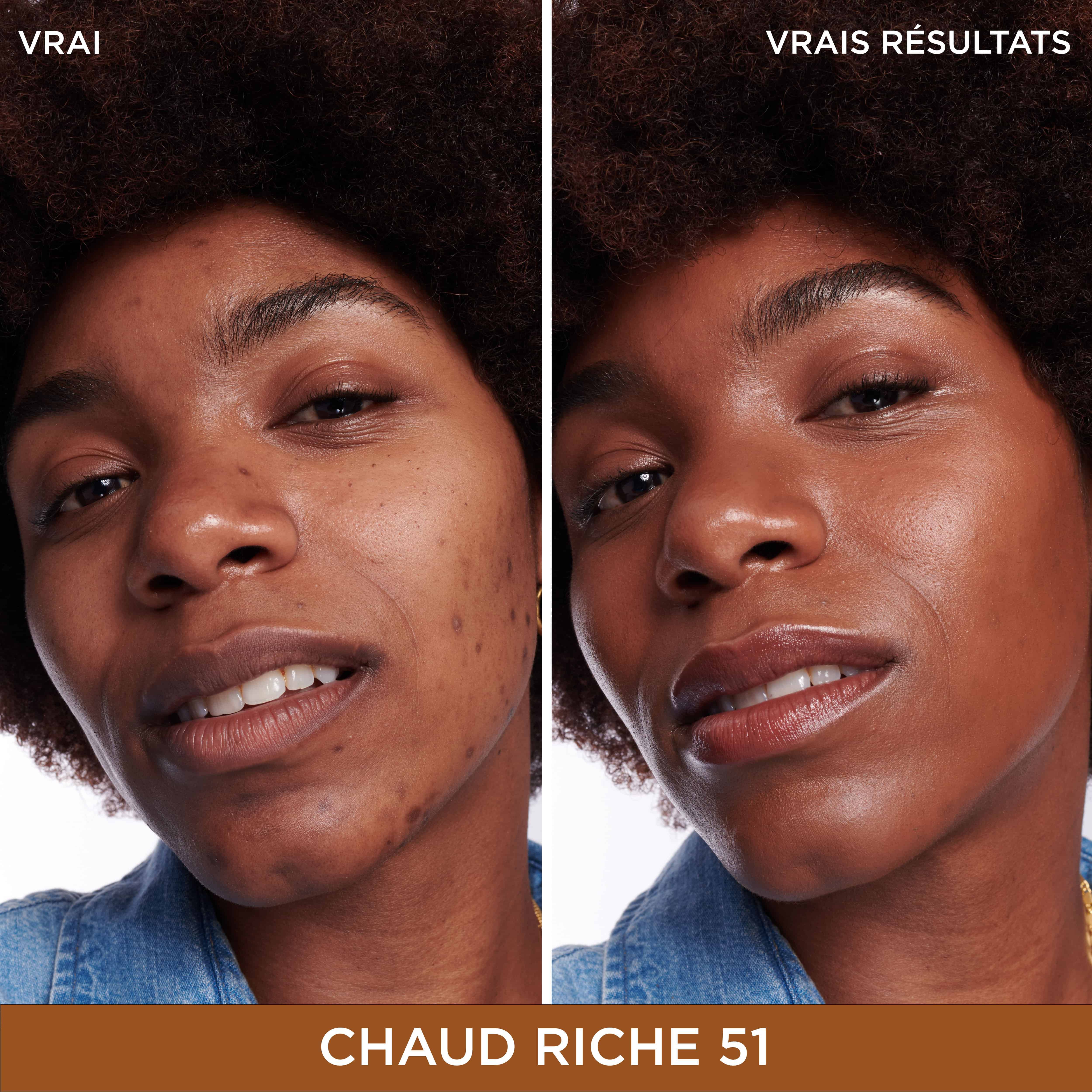 Bye Bye Dark Spots Cache-Cernes + Serum avec 2% de niacinamide